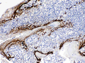 Anti-FDCSP Antibody