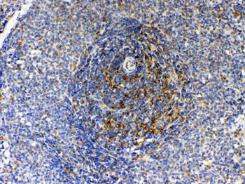 Anti-GAS 6/GAS6 Antibody