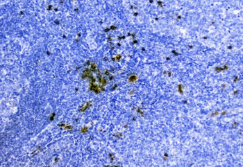Anti-Hemoglobin/HBA1/HBA2 Antibody