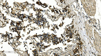 Anti-HDAC4 Antibody