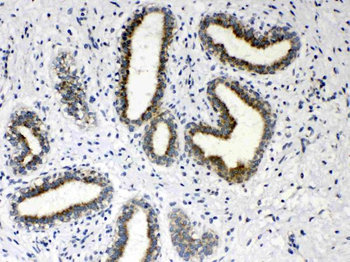 Anti-Hydroxysteroid (17-beta) Dehydrogenase 4/HSD17B4 Antibody