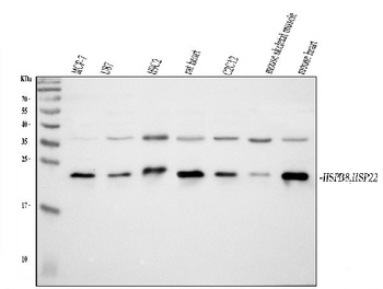 HSPB8/Hsp22 Antibody