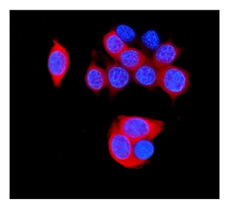 Anti-HSPB8/Hsp22 Antibody