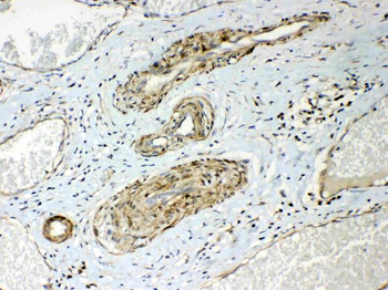 Anti-HSPB8/Hsp22 Antibody