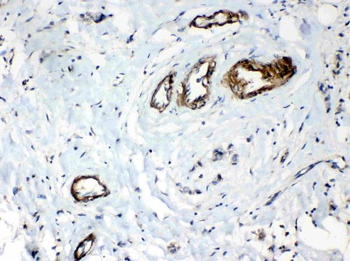Anti-HSPB8/Hsp22 Antibody