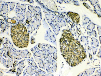 Anti-HSPB8/Hsp22 Antibody