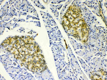 Anti-HSPB8/Hsp22 Antibody