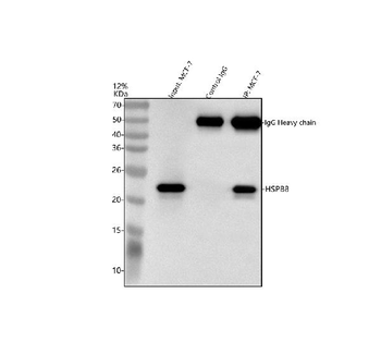 Anti-HSPB8/Hsp22 Antibody