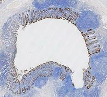 Anti-Cytokeratin 8/KRT8 Antibody