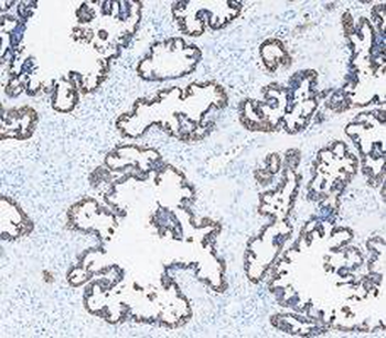 Anti-Cytokeratin 8/KRT8 Antibody