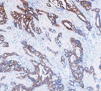 Anti-Cytokeratin 8/KRT8 Antibody