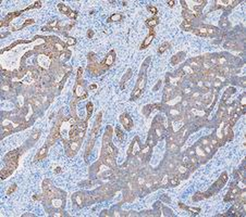 Anti-Cytokeratin 8/KRT8 Antibody
