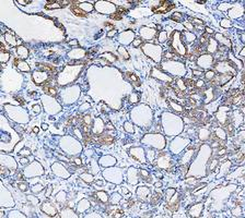 Anti-Cytokeratin 8/KRT8 Antibody