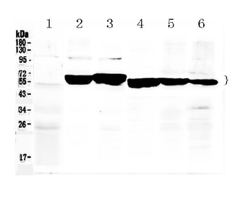 Anti-Cytokeratin 8/KRT8 Antibody