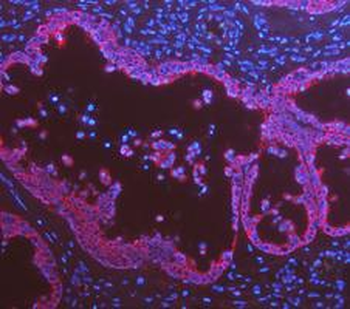 Anti-Cytokeratin 8/KRT8 Antibody