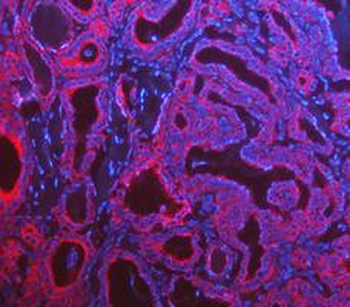 Anti-Cytokeratin 8/KRT8 Antibody
