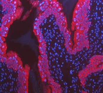 Anti-Cytokeratin 8/KRT8 Antibody