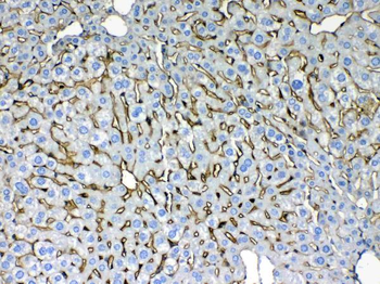 Anti-Cytokeratin 8/KRT8 Antibody