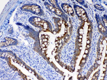 Anti-Cytokeratin 8/KRT8 Antibody