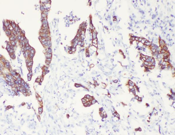 Anti-Cytokeratin 8/KRT8 Antibody