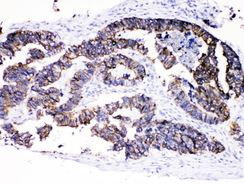 Anti-Cytokeratin 8/KRT8 Antibody
