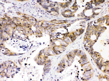 NDRG3 Rabbit Polyclonal Antibody