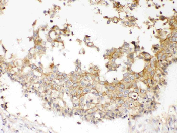Anti-NDRG3 Antibody