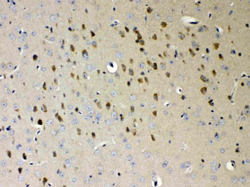 Anti-NDRG3 Antibody