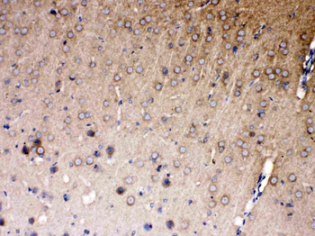 Anti-NDRG3 Antibody