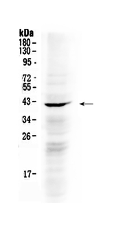 Anti-NDRG3 Antibody