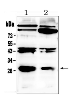 PDGF beta/PDGFB Rabbit Polyclonal Antibody