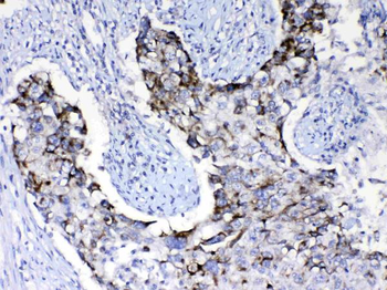 PI3 Kinase p110 beta/PIK3CB Antibody