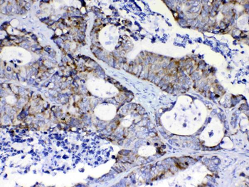 Anti-PI3 Kinase p110 beta/PIK3CB Antibody