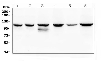 Anti-PI3 Kinase p110 beta/PIK3CB Antibody