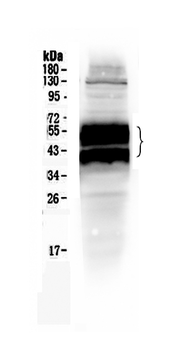 uPA Receptor/PLAUR Rabbit Polyclonal Antibody