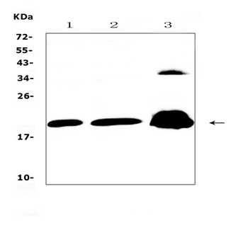 CPI17 alpha/PPP1R14A Antibody