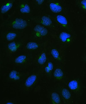 Anti-CPI17 alpha/PPP1R14A Antibody