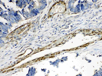 Anti-CPI17 alpha/PPP1R14A Antibody