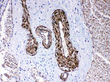 Anti-CPI17 alpha/PPP1R14A Antibody