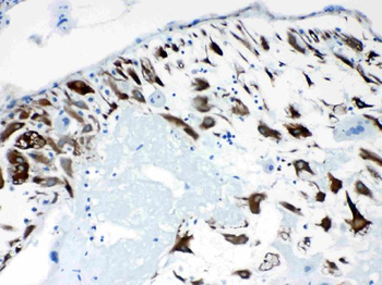 Anti-CPI17 alpha/PPP1R14A Antibody