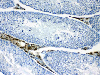 Anti-CPI17 alpha/PPP1R14A Antibody