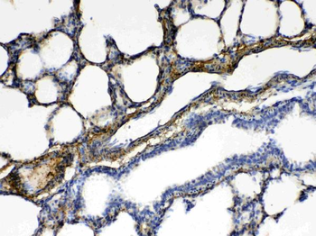 Anti-CPI17 alpha/PPP1R14A Antibody