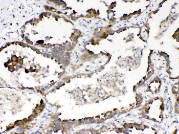 Anti-RanBP1 Antibody