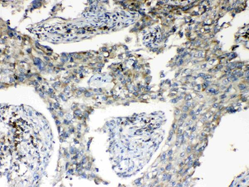 Anti-RPS6 Antibody