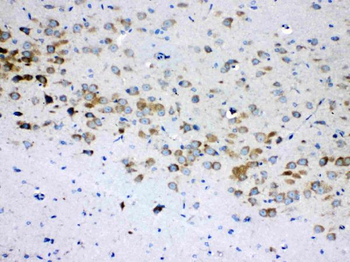 Anti-RPS6 Antibody