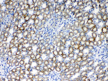 Anti-RPS6 Antibody