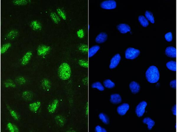 Anti-STAT1 Antibody