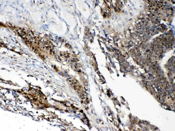 Anti-STAT1 Antibody