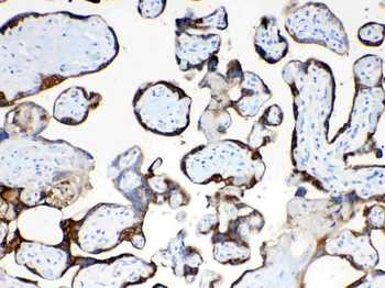 Anti-TFPI2 Antibody