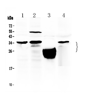 Anti-TFPI2 Antibody